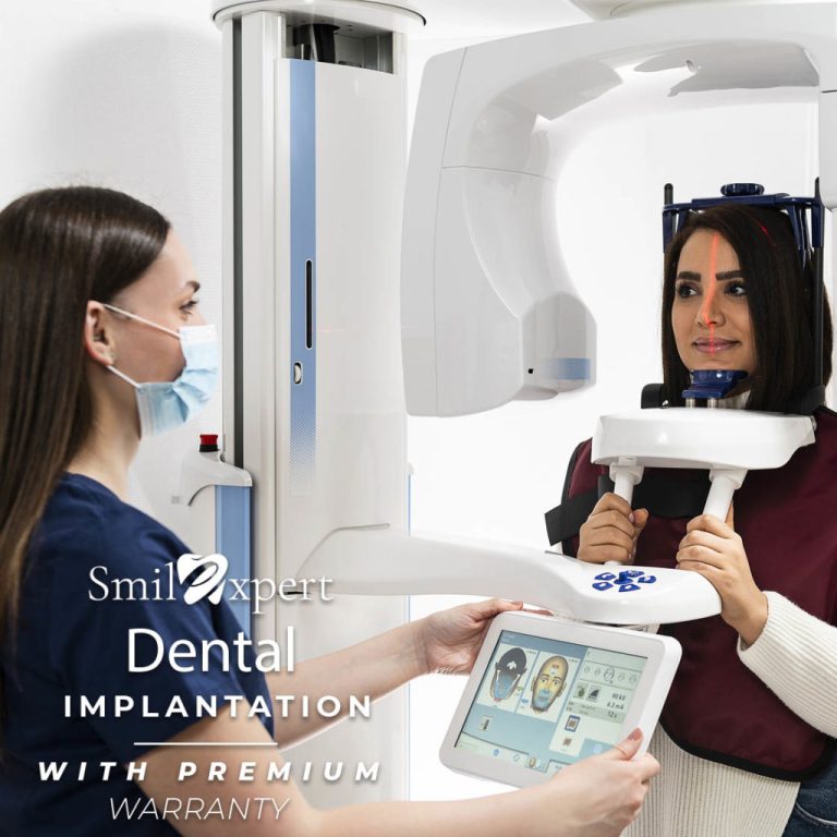 Allon4 dental implants Hungary Implant supported full dentures