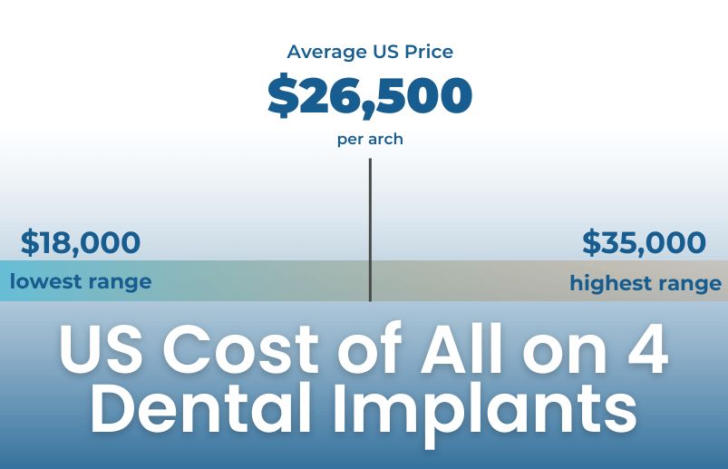 Dental implants costs US - full arch reconstruction