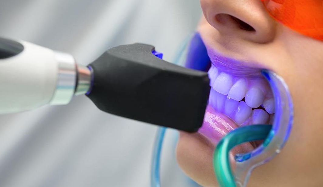 Philips ZOOM teeth whitening available at our clinic offers a more advanced and effective solution than standard whitening treatments.